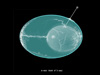 Egg-ray